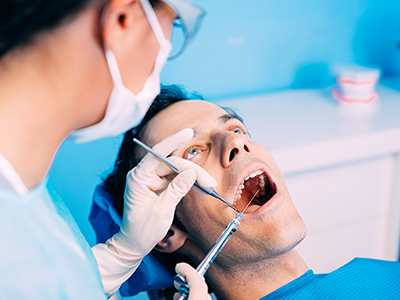 Why Men Hair Transplant